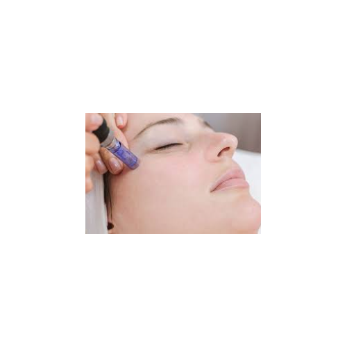 microneedling slika s penom